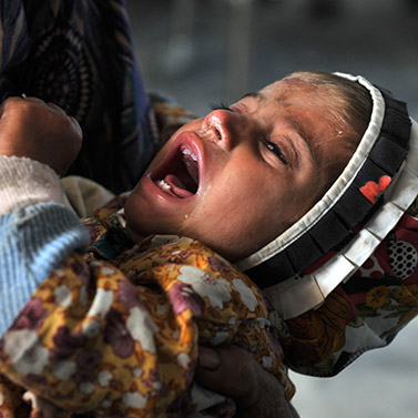 Infant mortality in Pakistan 